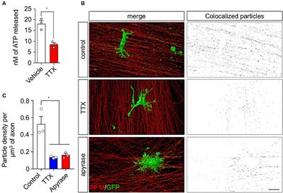 Neuronal activity-dependent ATP enhances the pro-growth effect of repair Schwann cell extracellular vesicles by increasing their miRNA-21 loading